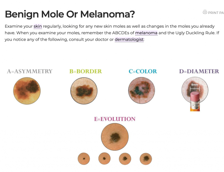 Melanoma Monday - The ABCs of Skin Cancer - Grace Medical Clinic ...