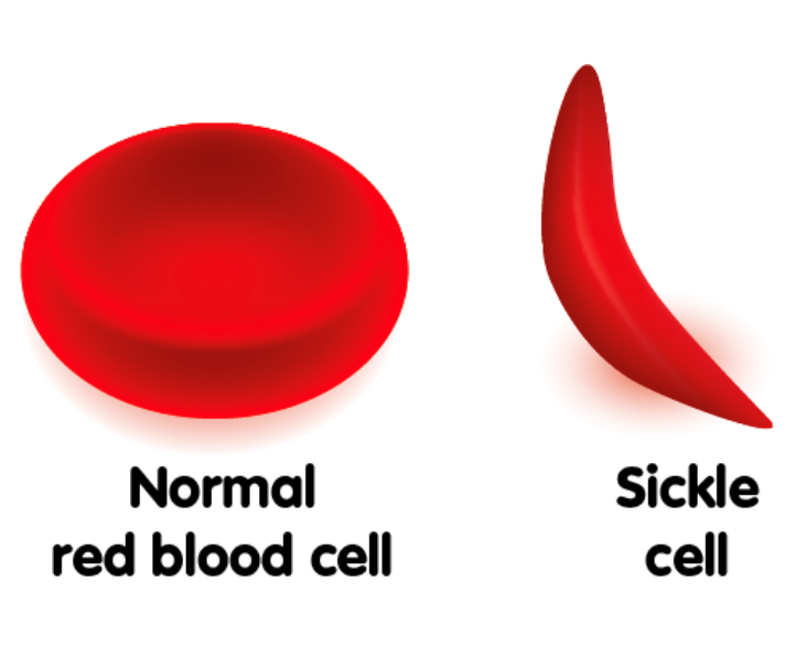 September is Sickle Cell Awareness Month - Grace Medical Clinic ...